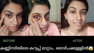 കണ്ണിനടിയിലെ കറുപ്പ് മാറ്റാം ഒരു ആഴ്ചയിൽ😱Remove dark circles#youtube #feed @Devuu259#skincare