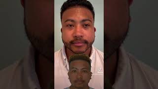 1 Year After 2000 FUE Beard Transplant | Anthony Bared MD, FACS | Miami, FL