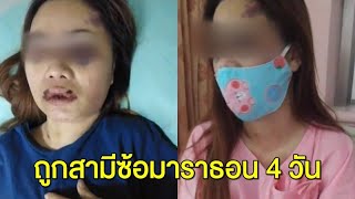 สาวร้องปวีณา ถูกสามีซาดิสม์เลี้ยงด้วยลำแข้ง ทำร้ายมาราธอน 4 วัน ซ้ำขับรถพาส่งขายตัว