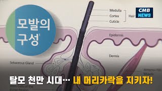 [대전뉴스] 탈모 천만 시대… 내 머리카락을 지키자