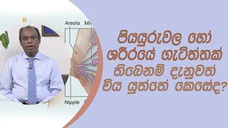 පියයුරුවල හෝ ශරීරයේ ගැටිත්තක් තිබෙනම් දැනුවත් විය යුත්තේ කෙසේද?|Piyum Vila|29-01 - 2021 | Siyatha TV