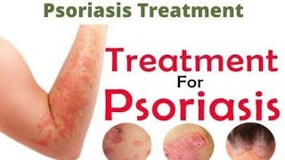 How To Cure Psoriasis Naturally | సోరియాసిస్ | Psoriasis Best Home Remedy | Psoriasis Natural Remedy