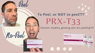 PRXT33 No peel, at home peel, DIY