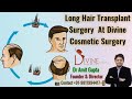 Long Hair Transplant Surgery At Divine Cosmetic Surgery