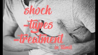 shock and it's types explanation in tamil