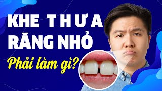 Khe Thưa - Răng Nhỏ | Phải Làm Gì?| Nam Bui Vinalign