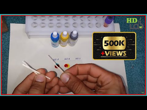 Blood Group Test Experiment Harib Diagnostic Lab Blood Group Test Experiment Harib Diagnostic Lab