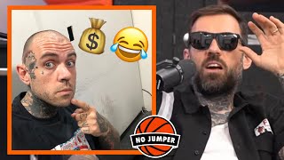 Adam Speaks On Spending $20K For a Hair Transplant