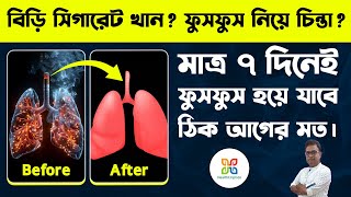 ধূমপান ছাড়তে পারছেন না ? ধূমপায়ীদের ফুসফুস সুস্থ রাখার কিছু ঘরোয়া টোটকা । Lungs detoxification.