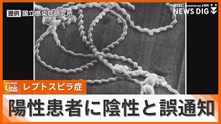 レプトスピラ症の陽性患者に陰性と誤通知 「検査工程でヒューマンエラー」衛生研が検体取り違え