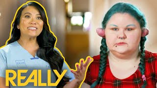 Dr Lee Removes Large Keloids From Cosplayer's Ears | Dr Pimple Popper: Pop Ups