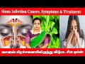 Sinus Infection Causes, Symptoms & Treatment || சைனஸ் பிரச்சனையிலிருந்து விடுபட சில டிப்ஸ் #sinus