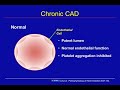 chronic coronary artery disease