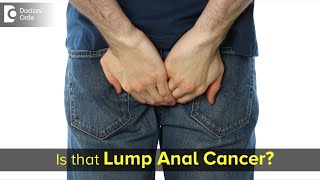 A lump down there – Is it cancer? Is it Piles ? Facts Revealed- Dr. Rajasekhar M R | Doctors' Circle