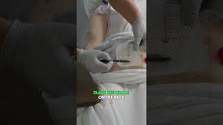 Colostomy Bag Change  - Nursing Clinical Skill DEMO