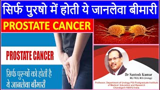 प्रोस्टेट कैंसर से बचना चाहते हैं?Dr.Santosh Kumar PGI से जानें प्रोस्टेट कैंसर से बचने के उपाय इलाज
