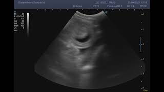 Intussusception ultrasound feline