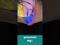 मुळव्याध म्हणजे काय मूळव्याधचे प्रकार ↪ 3d medical animation shorts piles hemorrhoid