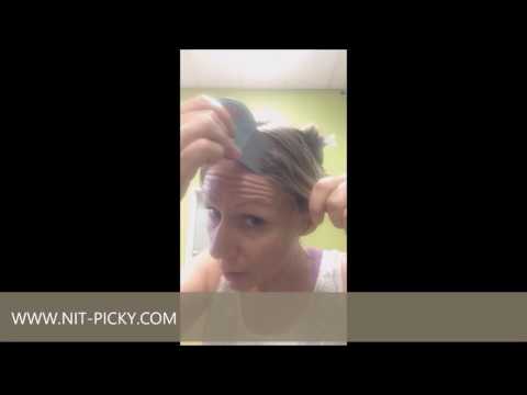 How to check yourself for head lice How to check yourself for head lice