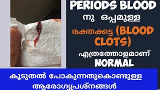 All about Menstrual Clots during Periods Malayalam