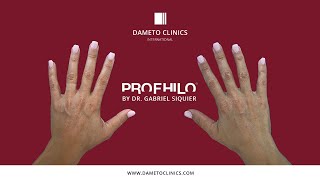 Dr Gabriel Siquier performing Profhilo on hands