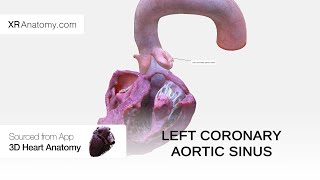 Left coronary aortic sinus