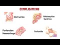 intestinal tuberculosis in 7 mins l pathology made easy