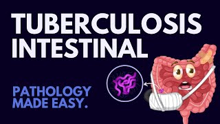 Intestinal Tuberculosis in 7 mins!  l Pathology Made Easy