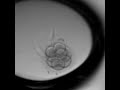 human embryo development video by cryoinnovation