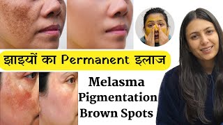 Jhaiyo ka Permanent Solution 100% | Jhaiya Pigmentation Melasma Home Remedy | Dr. Upasana Vohra