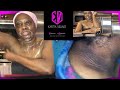 WONDERS OF HYDROGEN PEROXIDE ,ON DARK NECK,UNDER ARM AND UNEVEN SKIN TONE WITH TWO INGREDIENTS WONDERS OF HYDROGEN PEROXIDE ,ON DARK NECK,UNDER ARM AND UNEVEN SKIN TONE WITH TWO INGREDIENTS