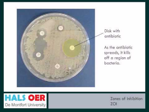What does a smaller zone of inhibition mean?