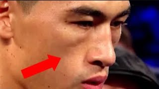 Dmitry Bivol vs Canelo | When Canelo feels capable of beating Bivol | Latest Boxing Highlights