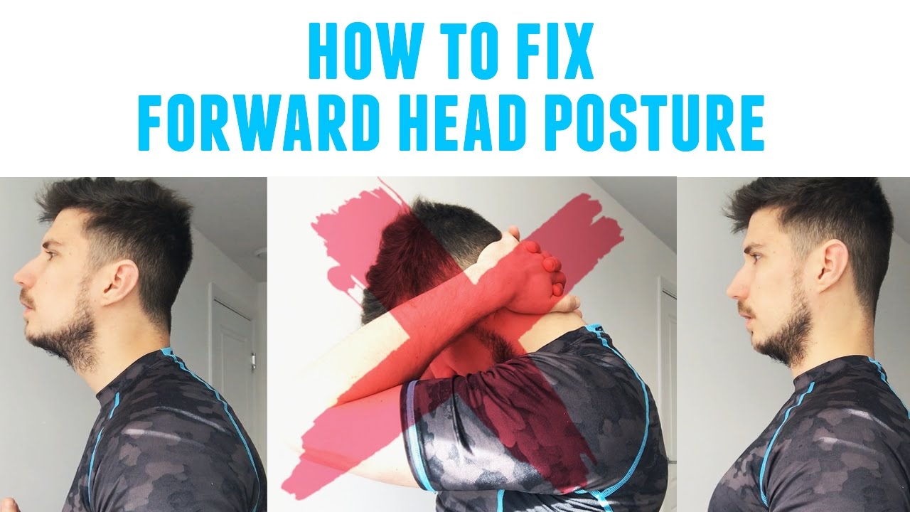 How To Fix Forward Head Posture Neck Stretches Video Neck Pain - YouTube