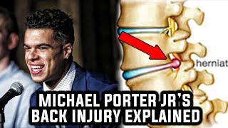 Everything that You Need to Know about Michael Porter Jrs Back Injury!