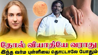 தோல் வியாதியே வராது இந்த வர்ம புள்ளியை தொட்டாலே போதும்  | Yogam