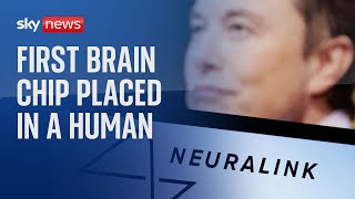 Elon Musk's Neuralink company implants brain chip in human for first time