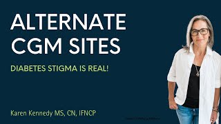 👉🏼Alternative Continous Glucose Monitor (CGM) Sites for FreeStyle Libre and Dexcom
