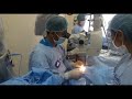 international surgical camp cambodia