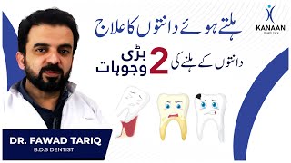 Moving teeth treatment  ہلتے ہوے دانت I teeth problem I teeth pain I dant hilne ka ilaj urdu