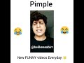 Dimple ki jagah Pimple😁😁😁 |BelikeeAabirr