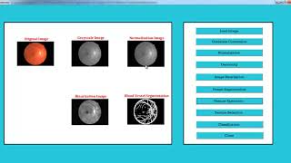 Final Year Project Image Processing | Final Year Project Image Processing Projects