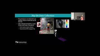 Developing Advanced statistical techniques to predict and characterize OA progression - Dr. K. Roach