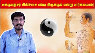 அக்குபஞ்சர் சிகிச்சை எப்படி தரப்படுகிறது என்று பார்க்கலாம் | Moondravathu kan | Nagaraj |Acupuncture