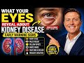what your eyes reveal about kidney disease | early warning signs