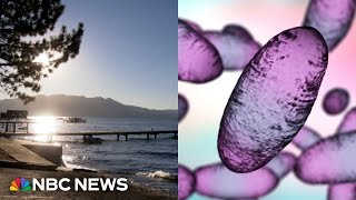 California resident tests positive for bubonic plague