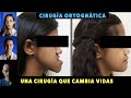 Esta cirugía cambia vidas, pero es la más temida: CIRUGIA ORTOGNÁTICA