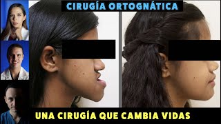 Esta cirugía cambia vidas, pero es la más temida: CIRUGIA ORTOGNÁTICA