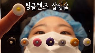 👀ASMR Tingle lens implantation surgery👁️