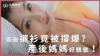 魔滴隆乳(俗稱)｜術後襯衫竟被撐爆！產後媽媽好驕傲！ — 法喬醫美診所邱浚彥醫師衛教案例